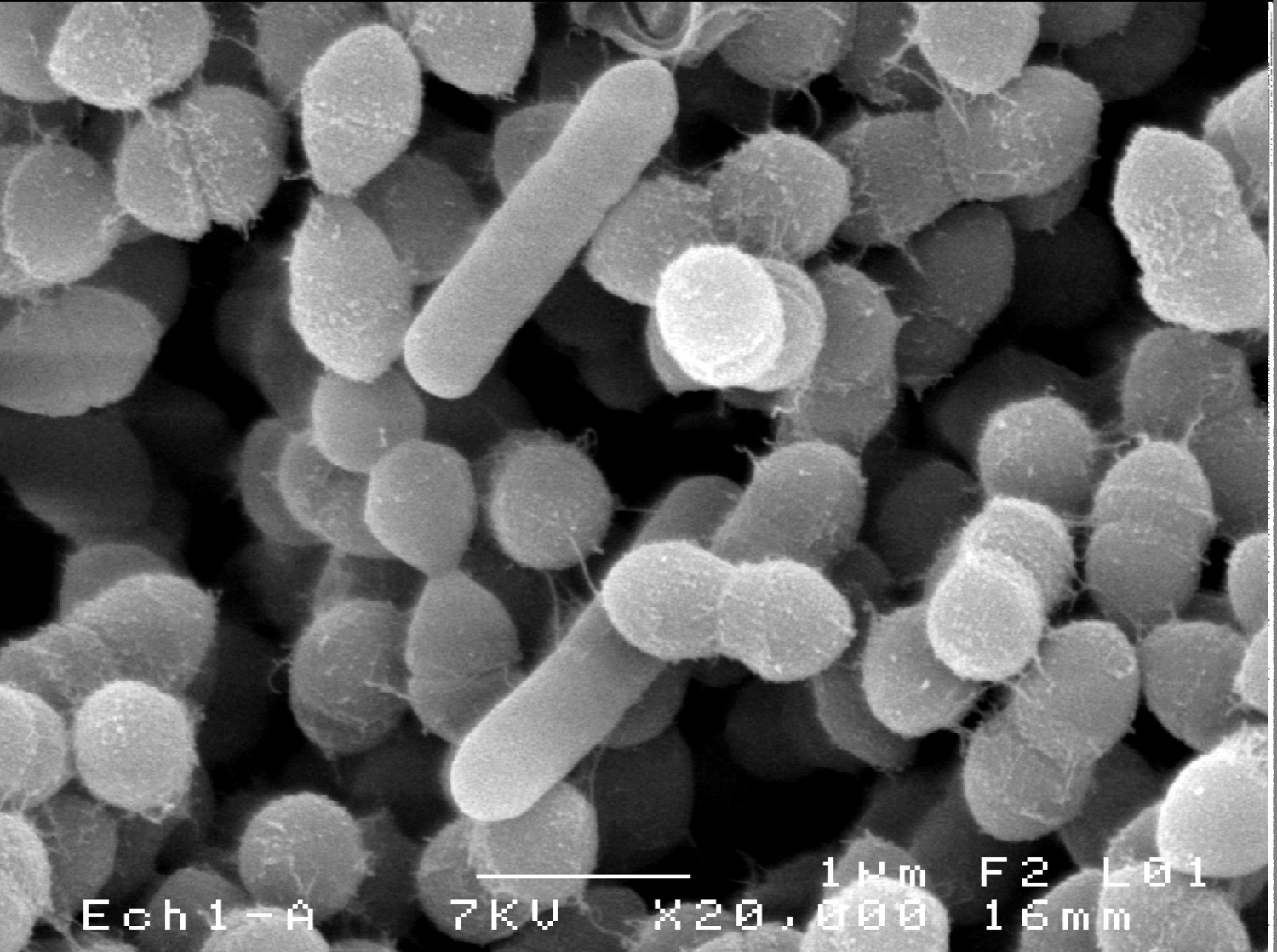 Lactococcus piscium en coculture avec Listeria monocytogenes. Photo au microscope électronique à balayage (x 20 000)